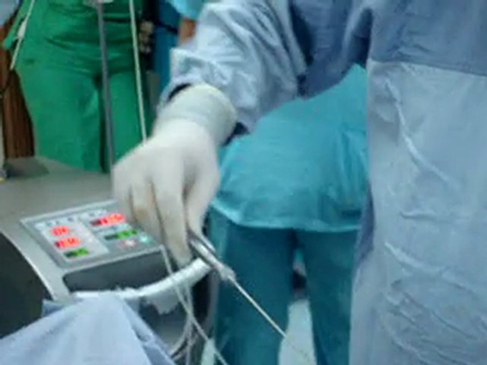 laser liposuctiondr. kamal al husseinyqatar فيديو Dailymotion