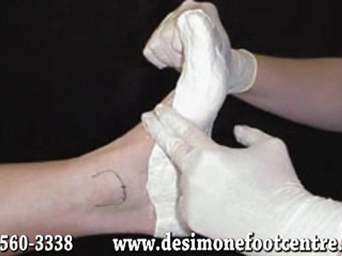 Custom Orthotics - Chiropodist in Sudbury, Elliot Lake and