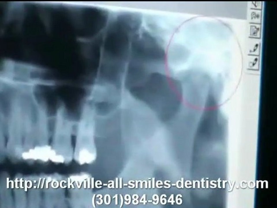 Digital Xray