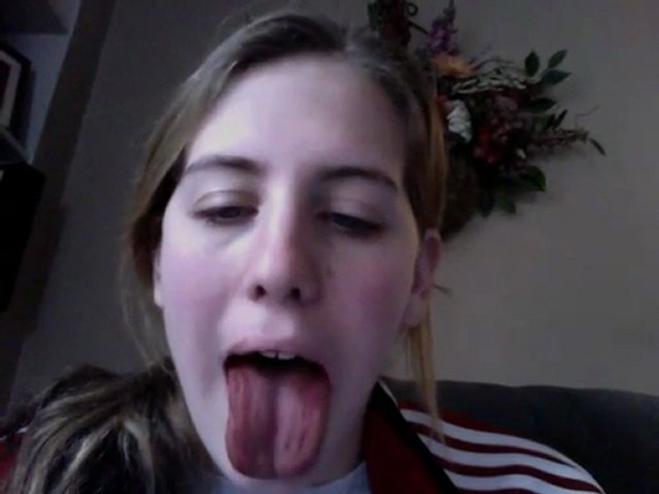 DAY 4 WISDOM TEETH NUMBNESS