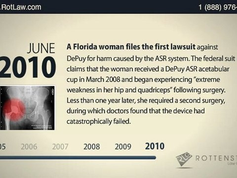 DePuy ASR Hip Recall