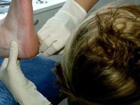 Podiatrists Arana Hills Advance Foot Clinic QLD