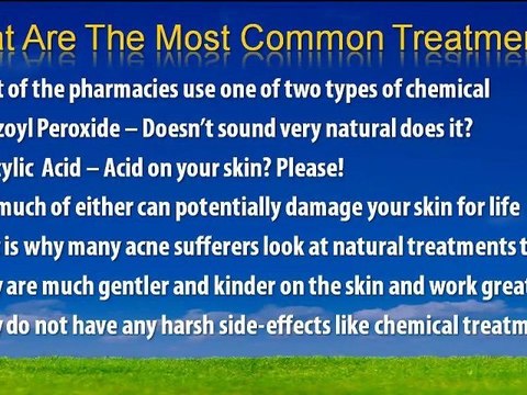 How Do You Get Rid Of Acne Using Household Products Part 1