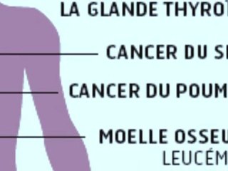 Infographie : les effets d'une forte exposition aux radiations