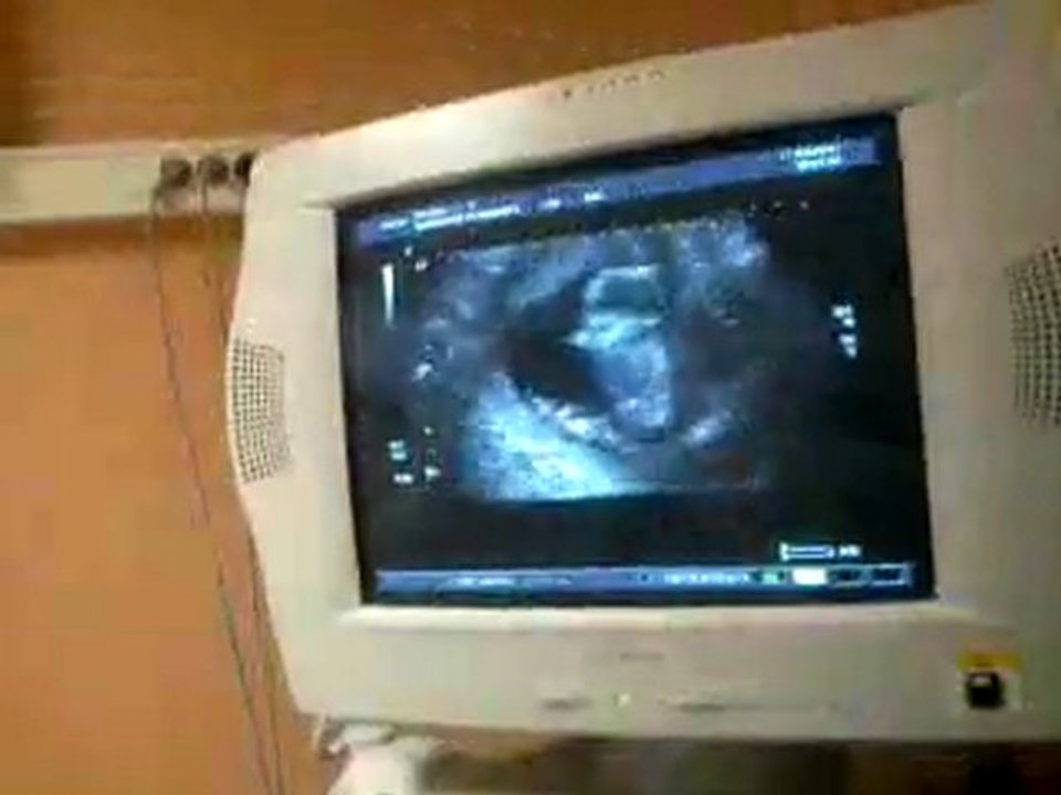 echo bb 3