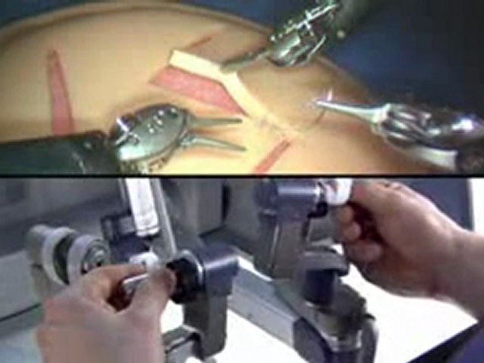 Da Vinci Surgical System