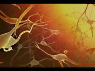 Migraine and Aura-Mayo Clinic