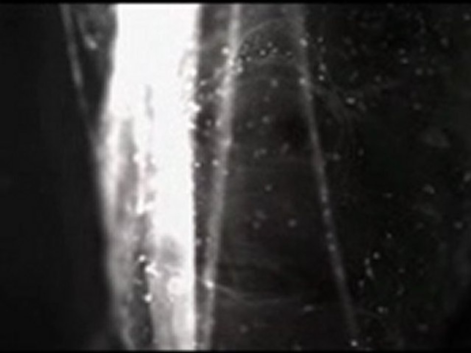 Everything Everything - Final Form - NOT the official video