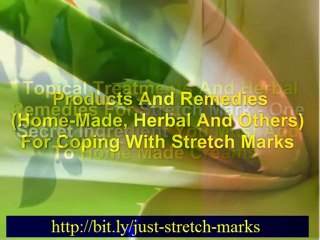 stretch marks pregnancy – stretch marks in pregnancy – stretch marks from pregnancy