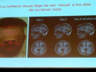 Plasticidad cerebral (2): Pascual-Leone
