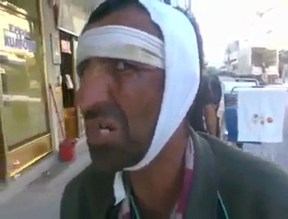 Kim vurmiş  xd