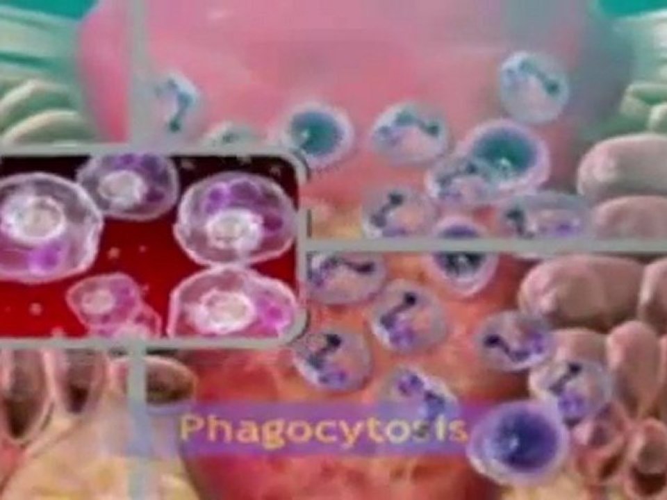 Acute Inflammation