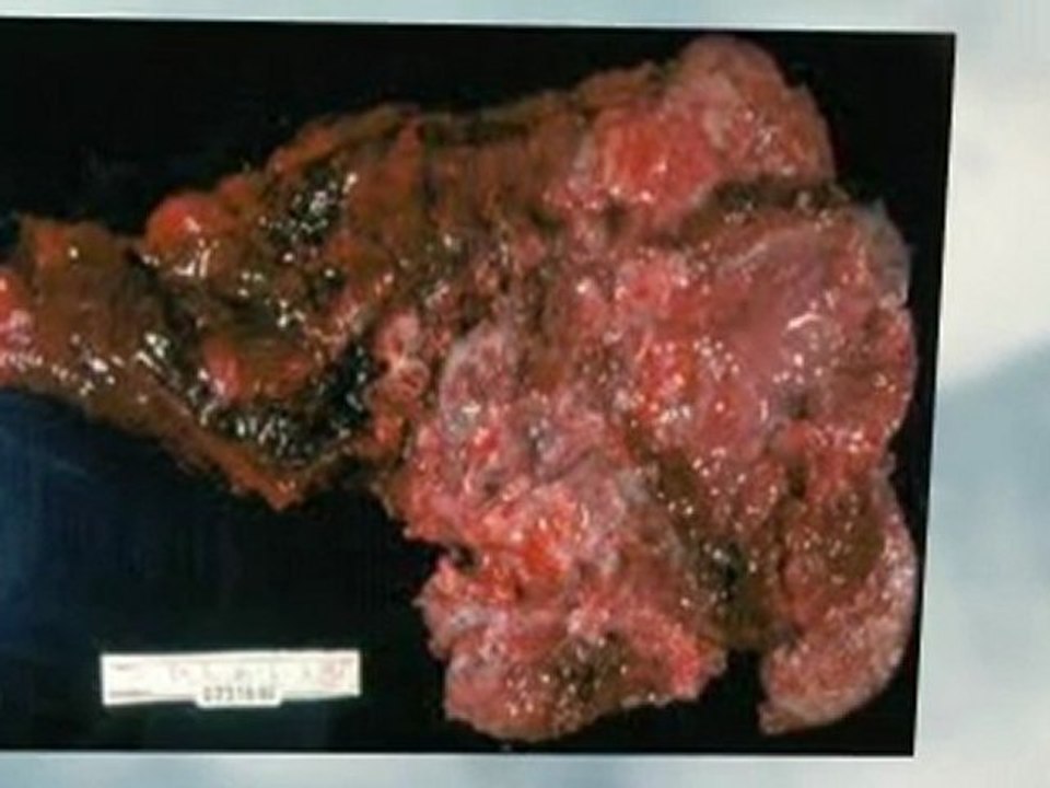 Asbestos Abatement Escondido