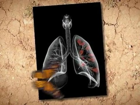 Asbestos Removal in Home Escondido