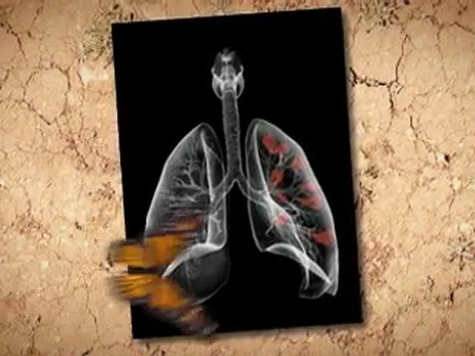 Asbestos Removal in Home Escondido