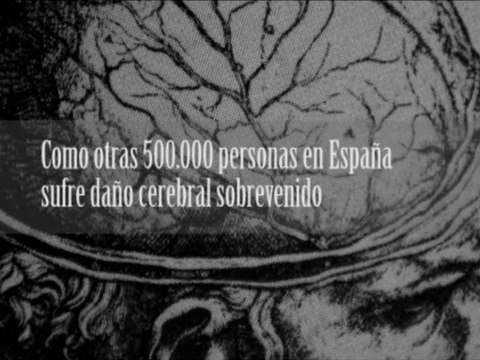 Amnesia: Daño cerebral adquirido