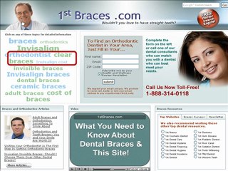 Find a Braces for dental braces