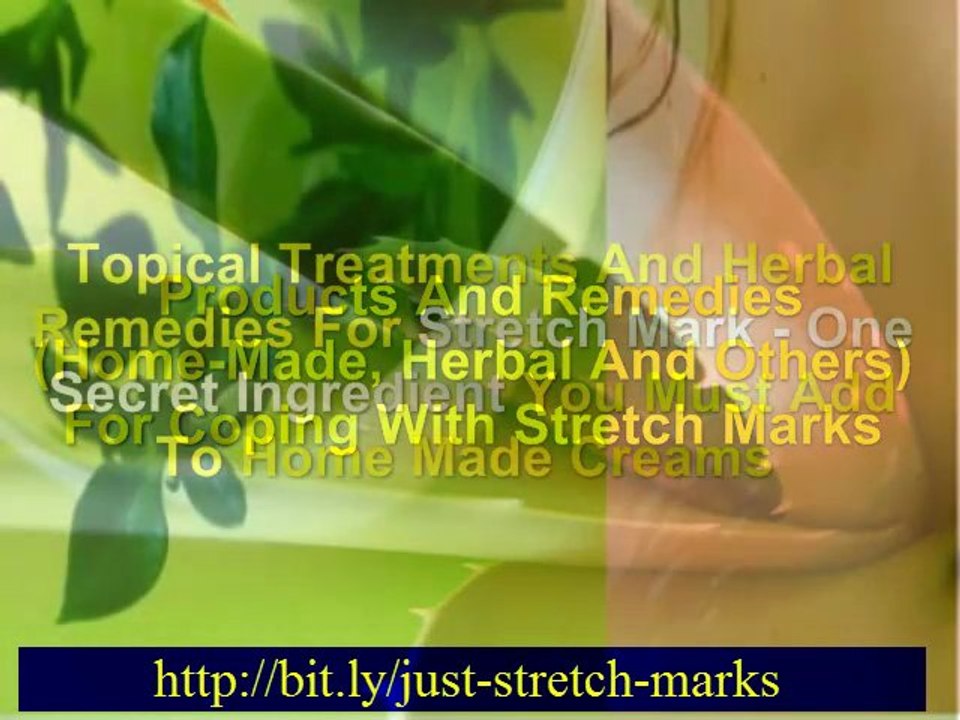 stretch marks remove -  what are stretch  marks – stretchmarks