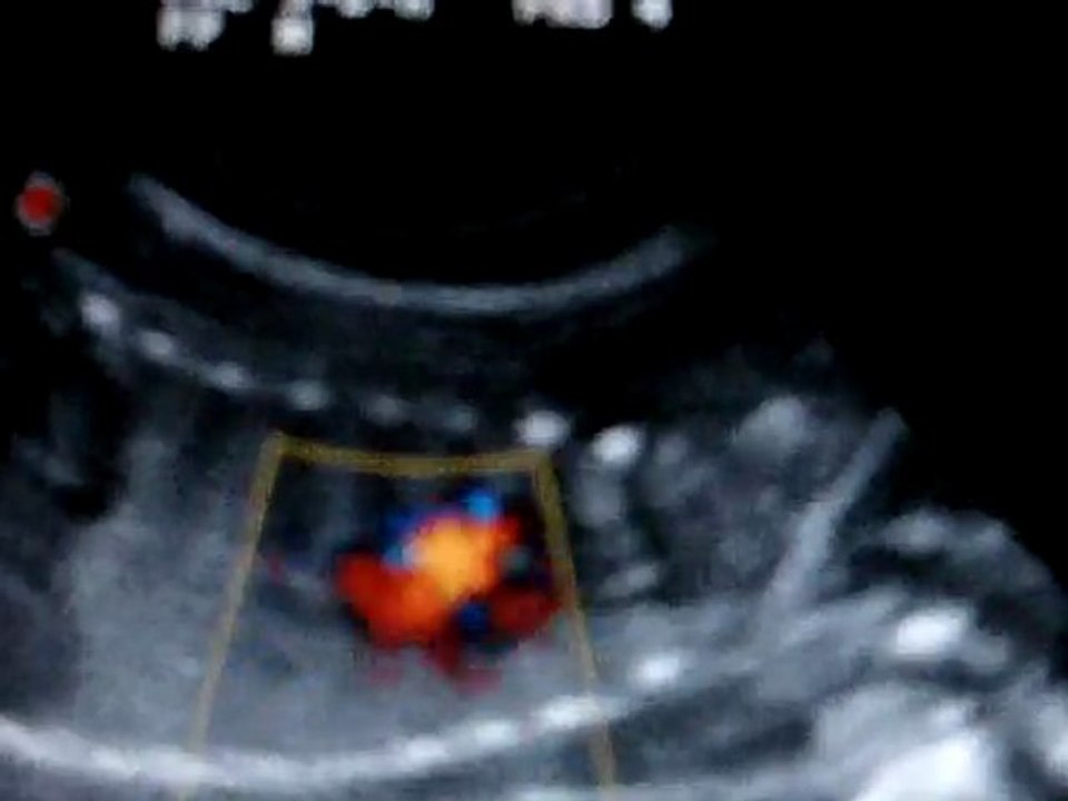 ECHO VANILLE 23 MARS 2011 001