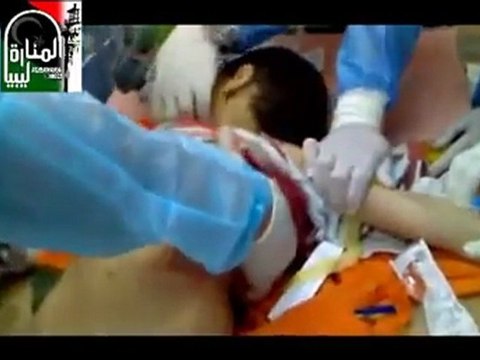 Libya: injured child in Benghazi yesterday