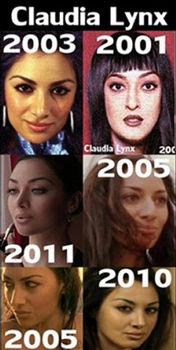 Claudia Lynx Real Face(plastic Surgery)