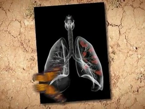 Asbestos Removal in Home Simi Valley