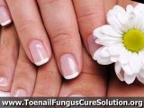 Tea Tree Oil Cure of Toenail Fungus