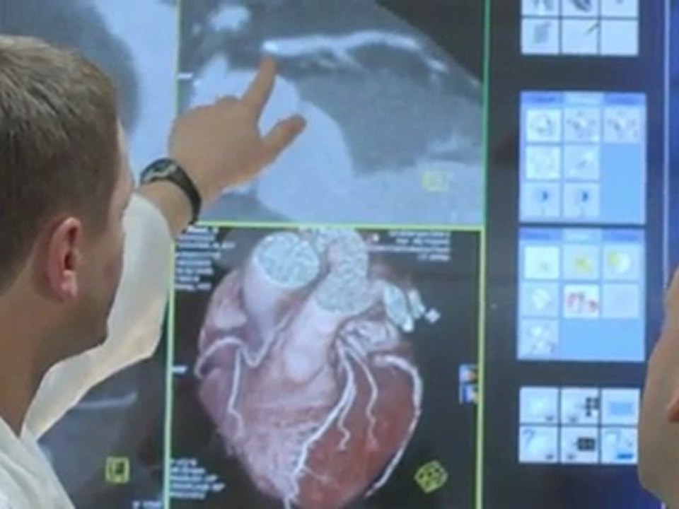 Herzerkrankung erkennen mit Computertomographie