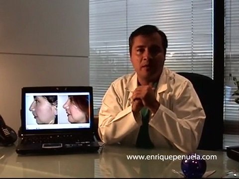 enriquepenuela.com - Implantes Faciales - dr. jorge enrique peñuela - Parte 2