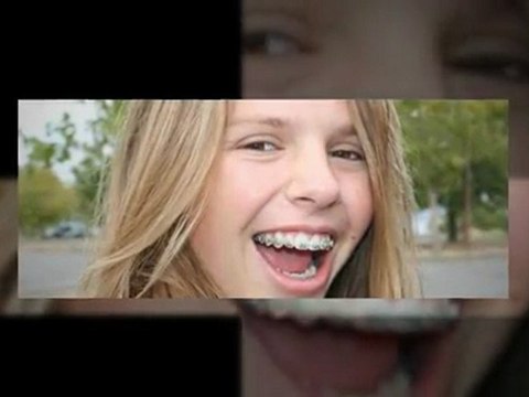 Westminster Invisalign Mar 2011