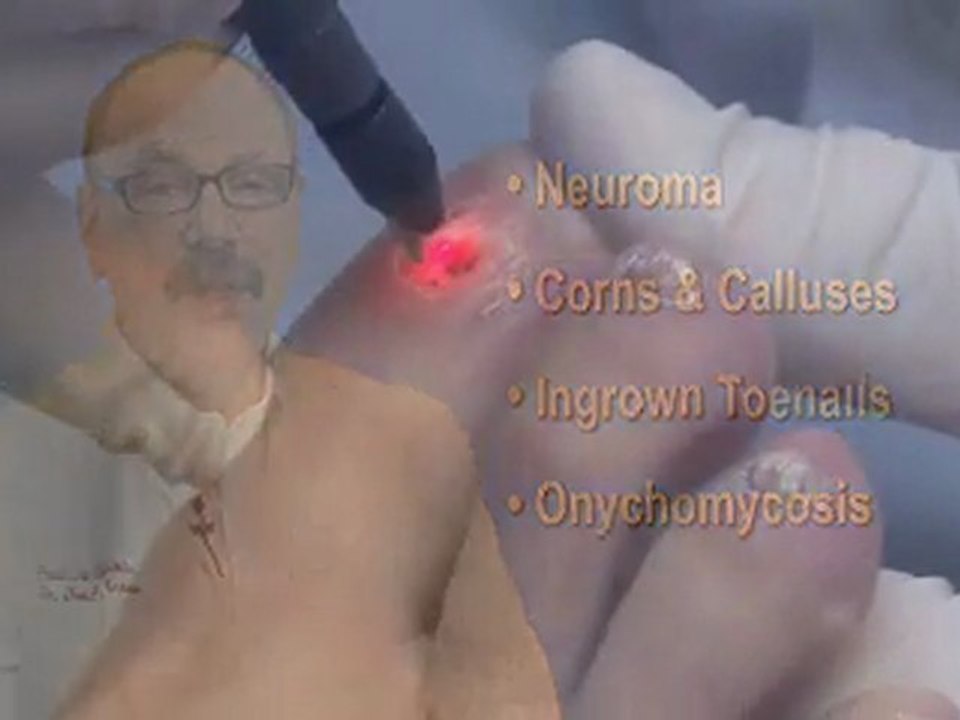 Podiatrist in San Mateo and Half Moon Bay, CA - David Kapla