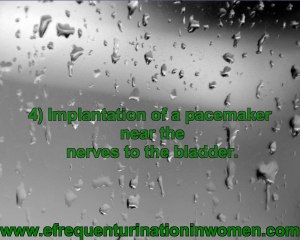 frequent urination in women