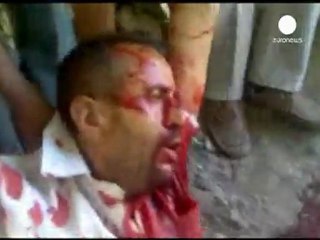 U.S appalled at Yemen violence