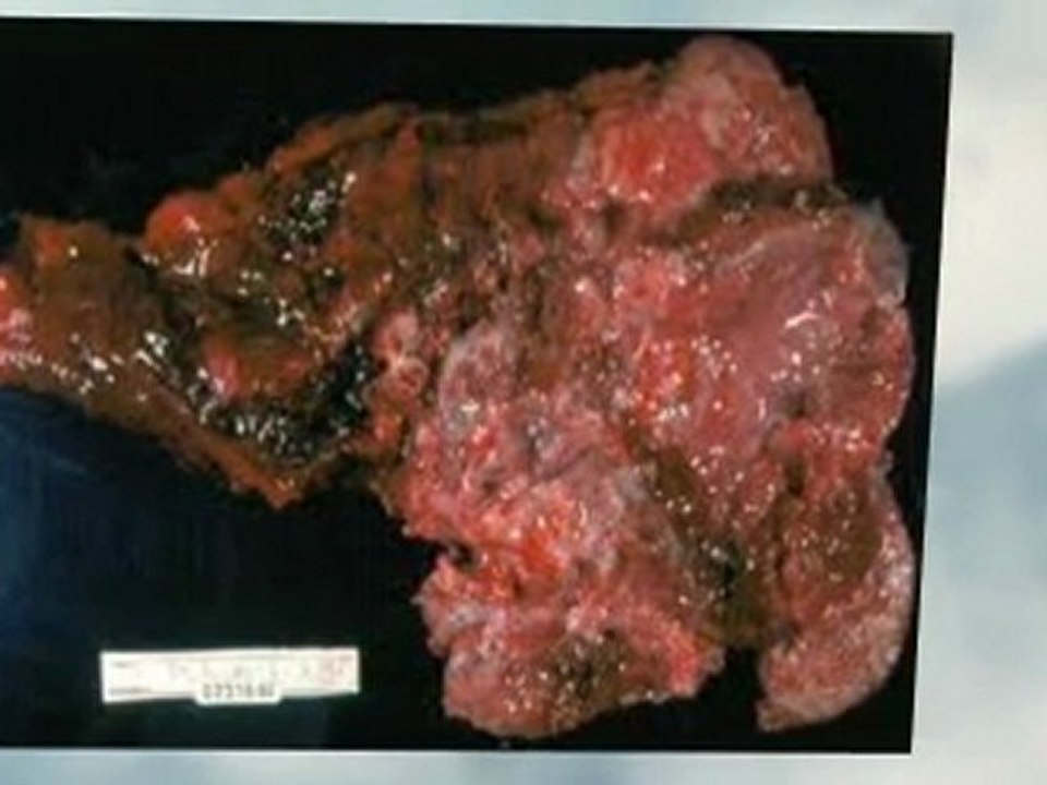 Asbestos Abatement Elmira