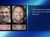 San Antonio Invisalign Cosmetic Dentist Dr. John Moore | Cosmetic Dental Associates