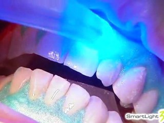 SmartLight3LT- Клиника лазерной стоматологии