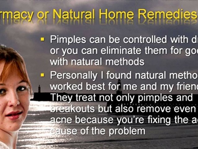 What is the best acne treatment?