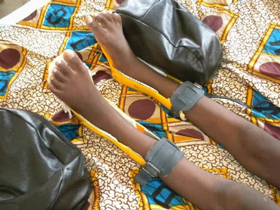 Congo Brazzaville : la rééducation kiné pour les patients atteints de poliomyélite