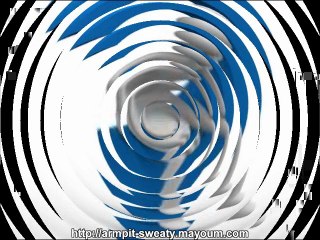 hyperhidrosis treatment