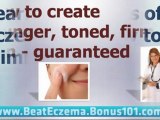 natural cures for eczema - natural treatment for eczema - eczema natural remedies