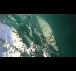 entrainement laser radial