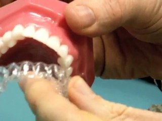 Orthodontist Corinda Tony Weir Orthodontist QLD