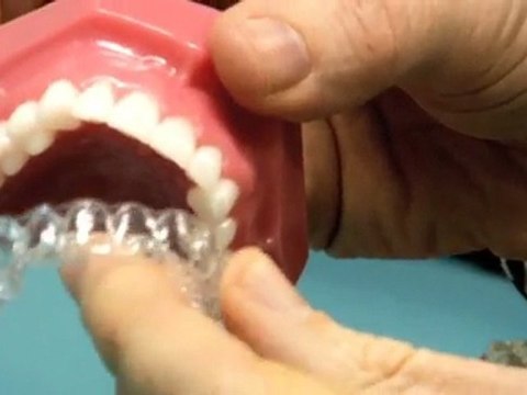 Orthodontist Corinda Tony Weir Orthodontist QLD