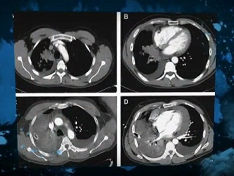 Asbestos Edwardsville