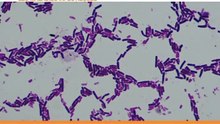 Les maladies infectieuses