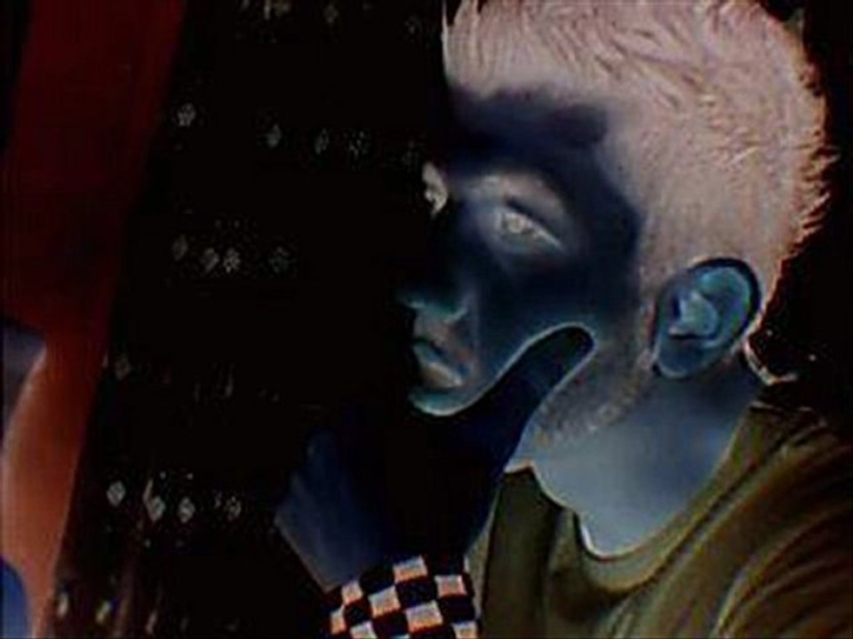 Sarımıyor Açtıgın YaraLar