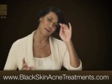 Acne treatment for black skin, Visit: http://www.blackskinacnetreatments.com, your online resource for acne treatments for African Americans.