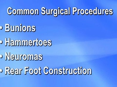 Foot and Ankle Surgery - Titusville, Fl Podiatrist