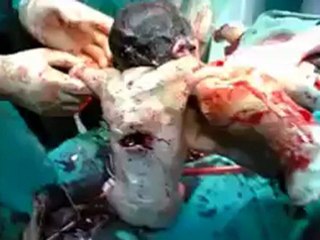 Numan Erdogan (1)_12