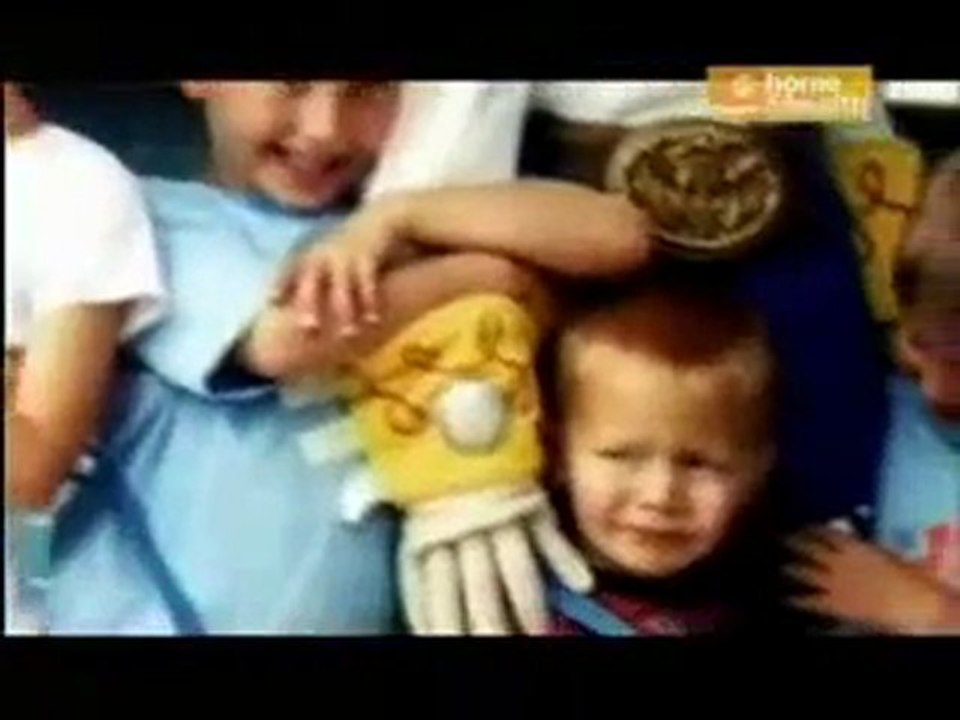 Cistinosis.  Sindrome de Falconi.   1 de 2
